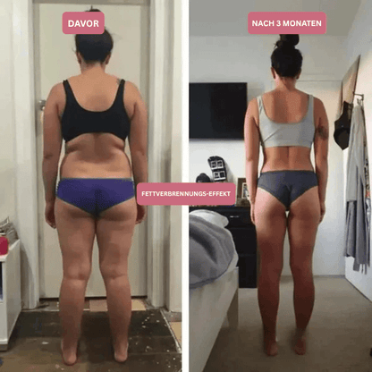 3D Anti-Cellulite Kompressionsleggings
