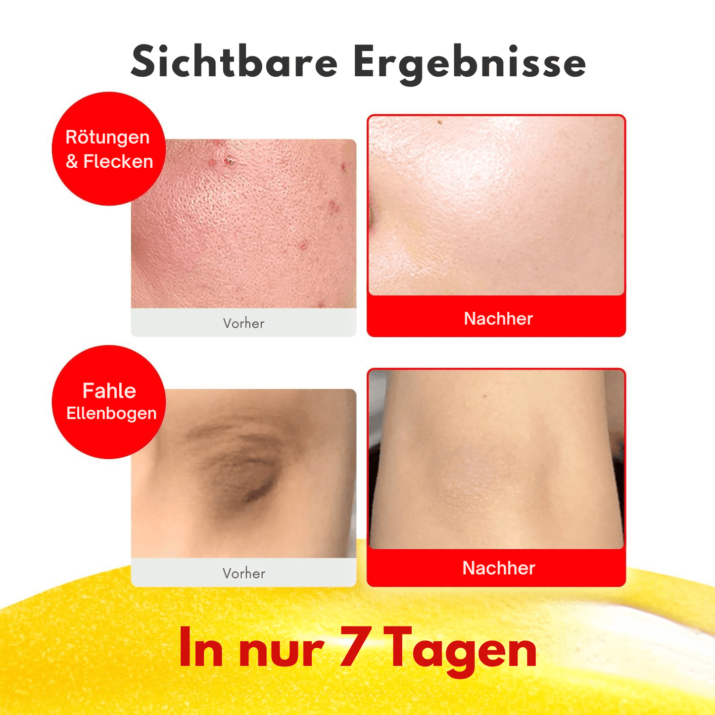 Vitamin C Pflege | Glow & Dark Spot Korrektur