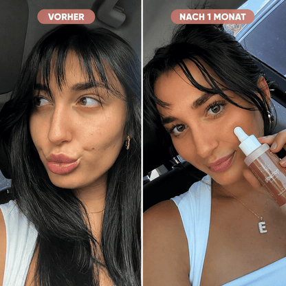 GlowDrop™ – Die Beauty-Drops für deinen Glow