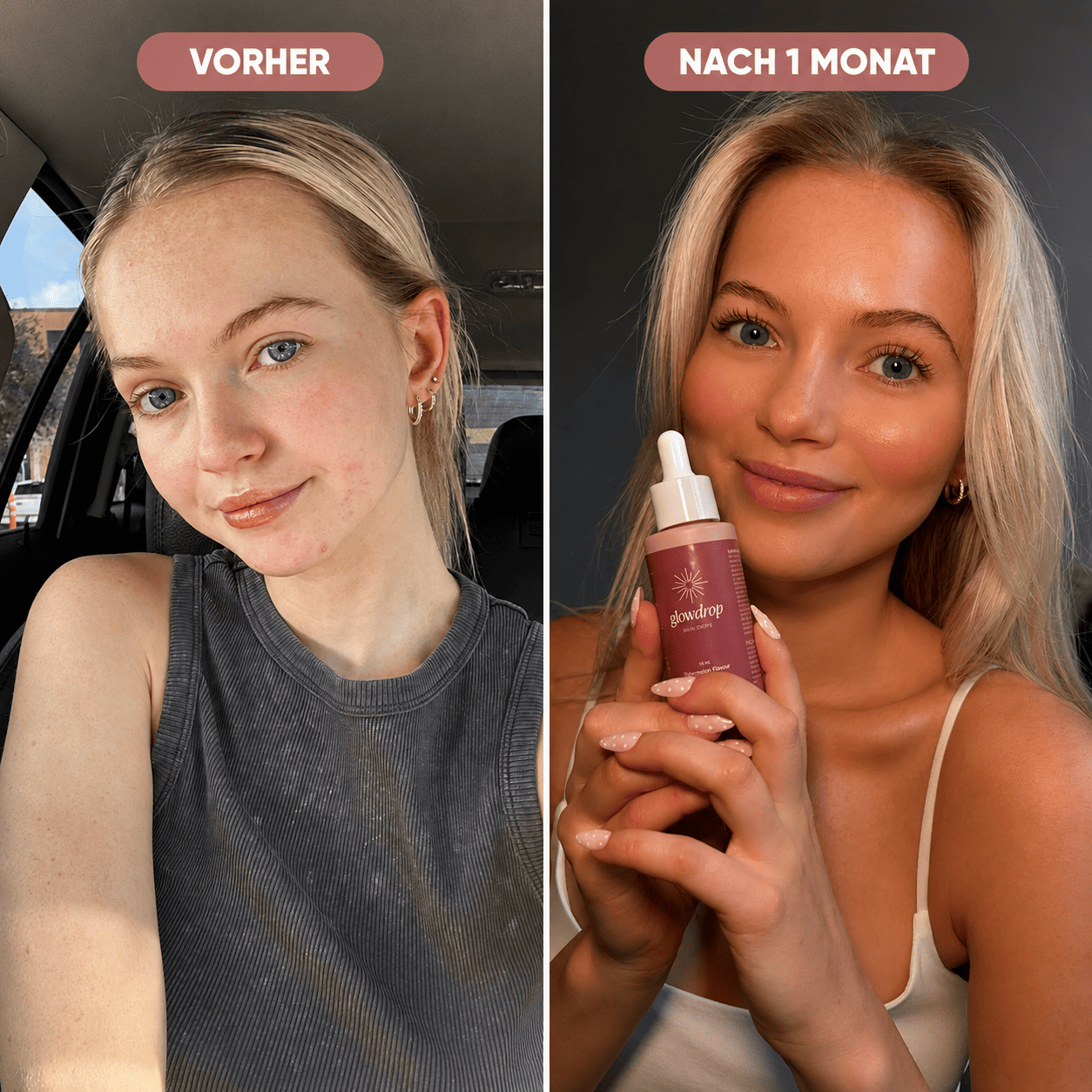 GlowDrop™ – Die Beauty-Drops für deinen Glow