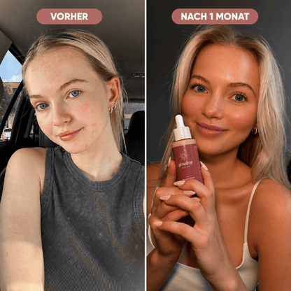 GlowDrop™ – Die Beauty-Drops für deinen Glow