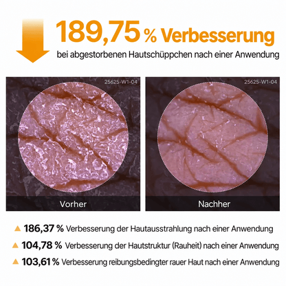 Das virale Peeling-Spray für glatte Haut